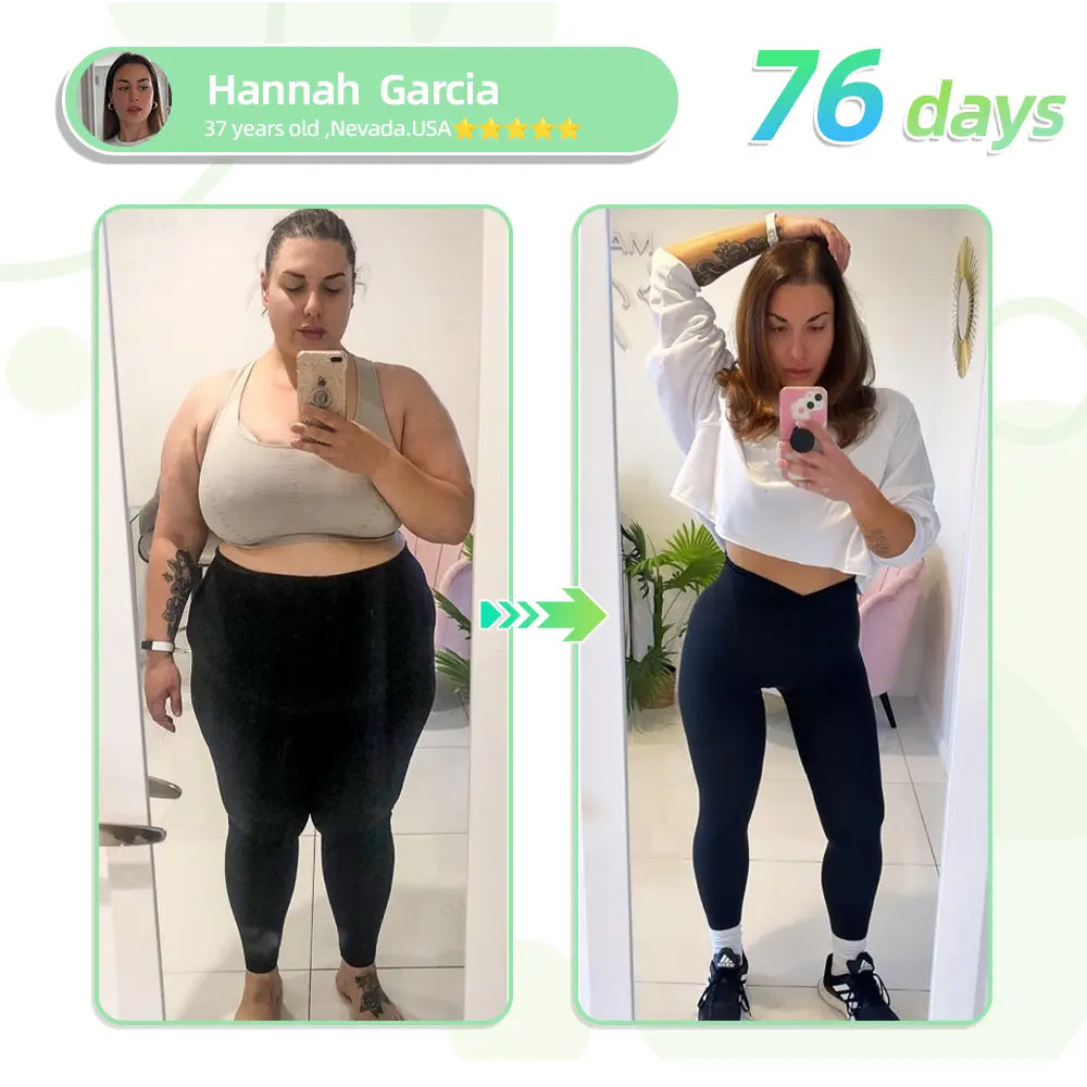 [See results in 7 days] ✅ GFOUK™ SMGT-GLP-1 Nano Microneedle Patch ✅ FDA certified (Painless, long-lasting, addressing diabetes, obesity, and cardiovascular diseases) 🍀up