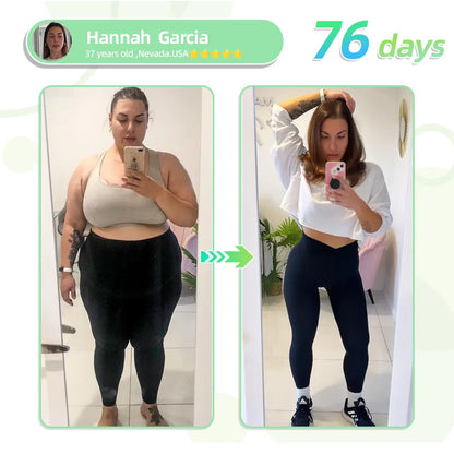 [See results in 7 days] ✅ GFOUK™ SMGT-GLP-1 Nano Microneedle Patch ✅ FDA certified (Painless, long-lasting, addressing diabetes, obesity, and cardiovascular diseases) 🍀up
