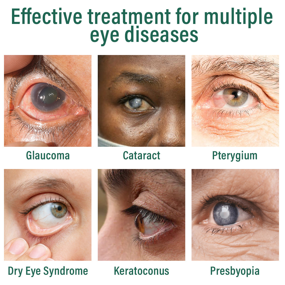 👩‍⚕️Ourlyard® Nano Eye Drops Serum ✅FDA Approved(Suitable for presbyopia, glaucoma, and cataracts) 🌿🌿