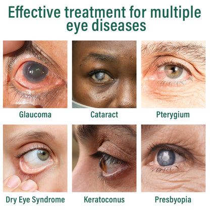 👩‍⚕️Ourlyard® Nano Eye Drops Serum ✅FDA Approved(Suitable for presbyopia, glaucoma, and cataracts) 🌿🌿
